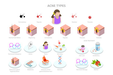 Fototapeta premium 3D Isometric Flat Conceptual Illustration of Acne Types, Skin Care