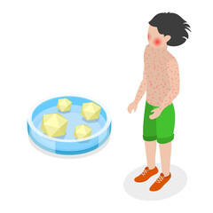 3D Isometric Flat  Conceptual Illustration of Fifth Disease, Kid Disorder