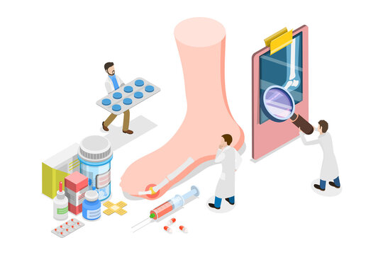 3D Isometric Flat  Conceptual Illustration of Gout Treatment, Medical Appointment and Exam