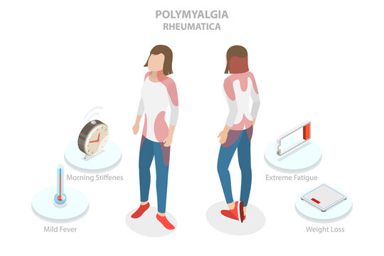 3D Isometric Flat  Conceptual Illustration of Polymyalgia Rheumatica , Problem Zones and Consequences