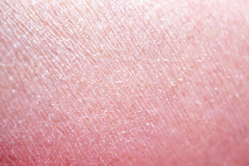 Fototapeta premium dry and dehydrated human skin texture background