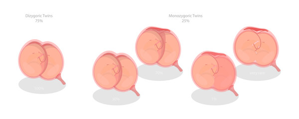 3D Isometric Flat  Conceptual Illustration of Embryo In Womb, Anatomy of Abdomen with Twins