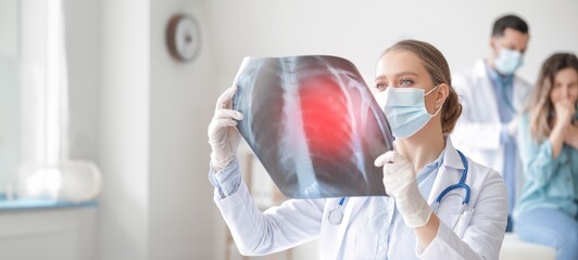 Female doctor with x-ray image of lungs in clinic. Banner for design