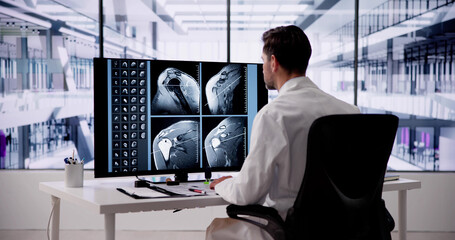 Doctor Screening Shoulder MRT Scan