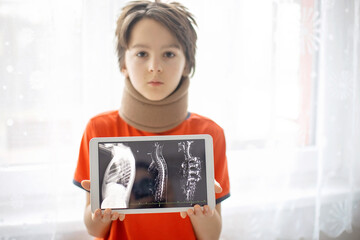 Preteen child, boy, holding tablet with picture of fractured thoracic spine, vertebralis, wearing...