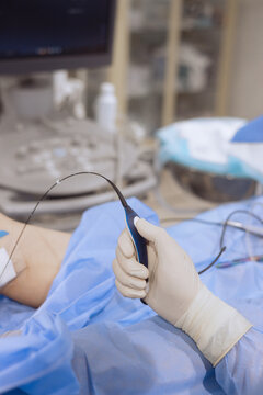 A surgeon holding an catheter equipment for Endovenous Radiofrequency Ablation during vericose veins treatment 