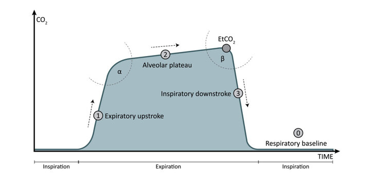 Vector Illustration of EtCO2 Capnography Waveform