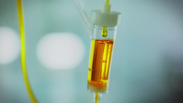 Medicinal liquid slowly drips from the bag, filling the iv drip transfusion system close-up. An infusion occurs when saline solution flows through the system through transparent tubes