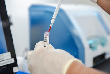 Eine medizinische Fachperson füllt eine Blutprobe in ein Gefäss zur Analyse in einem Labor.