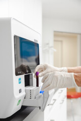 Eine medizinische Fachperson stellt eine Blutprobe in ein Gerät zur Analyse in einem Labor.