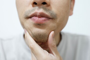 20代の日本人男性の無精髭