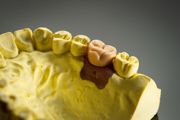  The image of a denture