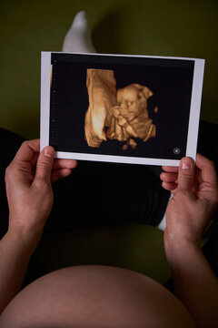 A pregnant woman holds a baby's ultrasound photo in her hands. Fertilization, pregnancy, women's consultation, obstetrics, childbirth. Child care, motherhood, health. Pregnancy test, abortion, clinic.