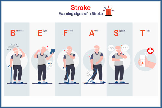 Medical illustration in flat style.Vector infographic of stroke signs and symptoms. Elderly male character.