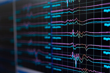 Surgical operating therapy. Monitoring neurosurgery system screen.
