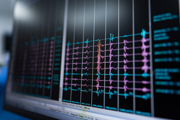 Medical healthcare screen monitoring. Interface futuristic science monitor.