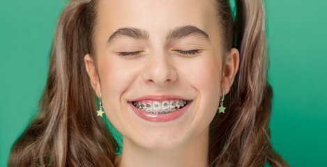 Portrait of smiling beautiful teenage girl with braces, pointing fingers at her charming smile.