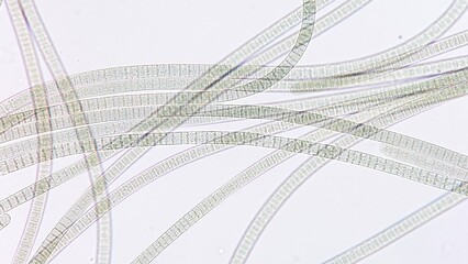 Freshwater cyanobacteria, Oscillatoria sp. Fresh sample. 920x magnification. Selective focus image