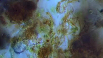 Fungal hyphae, Chlamydomonas green algae, Nostoc cyanobacteria in creek water - Powered by Adobe