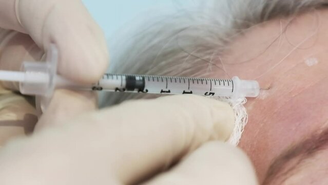 An older person receives an injection shot of Botox into the forehead to reduce wrinkles