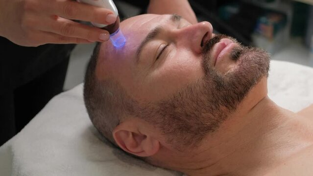 Closeup portrait of a handsome man with a beard microneedling with dermapen from a beautician.