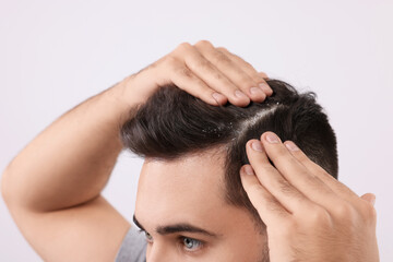 Fototapeta premium Man with dandruff in his dark hair on light grey background, closeup