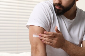 Man with dry skin applying cream onto his arm indoors, closeup. Space for text
