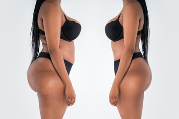 Tummy tuck, fat body before and after weight loss and liposuction on gray background, black African woman, plastic surgery concept - obrazy, fototapety, plakaty