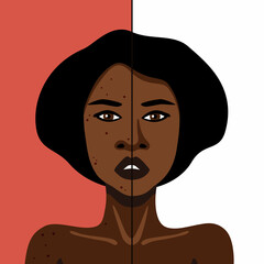 Vector image of African American woman witn acne on skin treatment minimalistic illustration