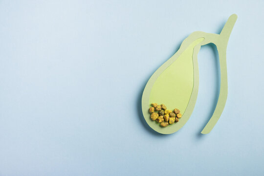 Gallbladder decorative model with gallstones on pastel blue background. Gallbladder disease concept. Top view, copy space
