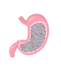 Stomach with gas and bloating feeling. Human internal organ disorder pathology. Vector illustration