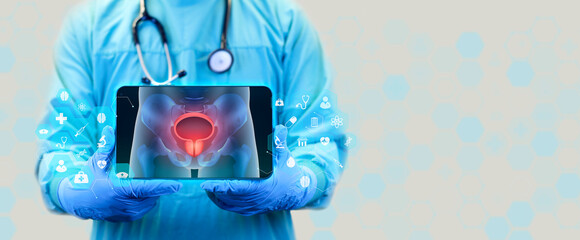 The doctor analyzes the simple x-ray of the male pelvis. the bladder and prostate are observed. Prostate cancer, bladder cancer, men's healthcare. Urologist with tablet. - obrazy, fototapety, plakaty