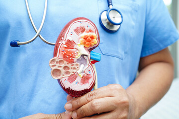 Chronic kidney disease, doctor with model for treatment urinary system, urology, Estimated...