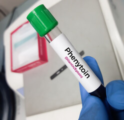 Blood sample for Phenytoin test, therapeutic drug, to maintain a therapeutic level and diagnose...