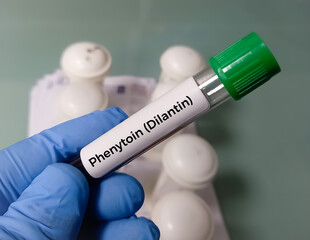 Blood sample for Phenytoin test, therapeutic drug, to maintain a therapeutic level and diagnose...