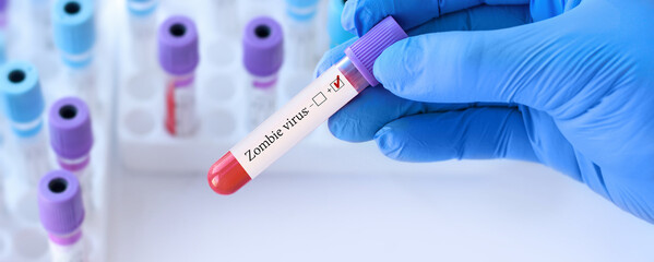 Doctor holding a test blood sample tube with positive Zombie virus test on the background of...