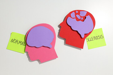 A model of a healthy and brain damaged by sclerosis