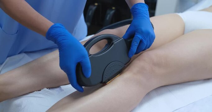 Woman legs and elos laser hair removal. Laser hair removal and photoepilation