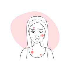 Sad young woman with pimply skin on face before acne treatment vector illustration