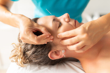A physiotherapist performs a facial acupuncture session on her patient to tone the muscles of the face