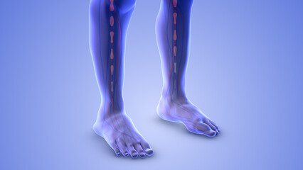 Lower limb edema or leg swelling
