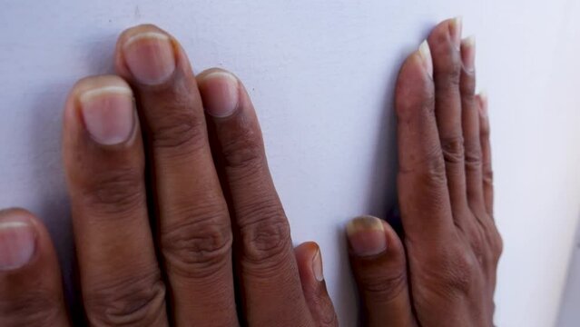 Macro shot of untrimmed nails on an Indian adult's hand. Body hygiene awareness concept