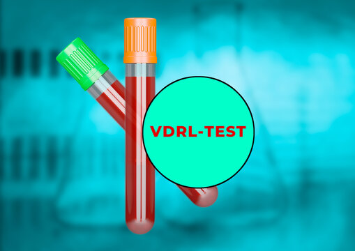 Human blood sample in the tube for VDRL test