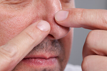 Man popping pimple on his nose against grey background, closeup