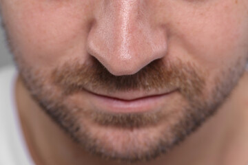 Closeup view of man with normal skin