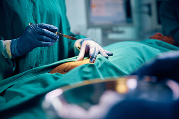 Close up of doctor using scalpel during surgery in operating room. - obrazy, fototapety, plakaty