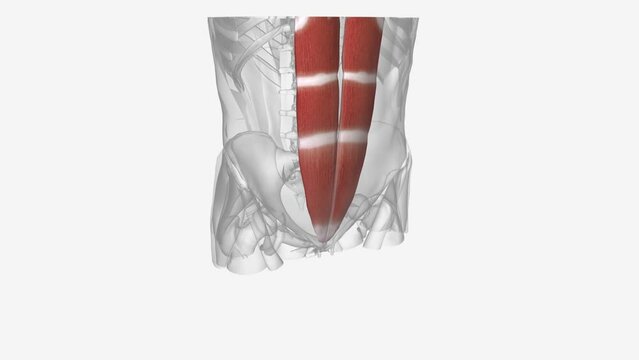 rectus abdominis slung between the ribs and the pubic bone at the front of the pelvis.
