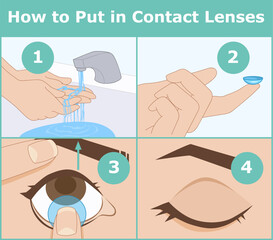 How to put in contact lenses. Instruction, infographic. Healthcare illustration. Vector illustration. 