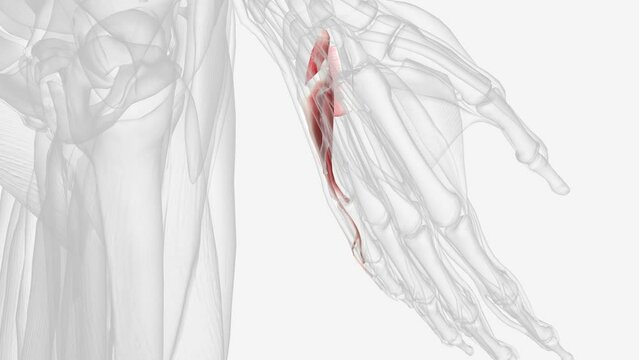 Hypothenar muscles of right hand .
