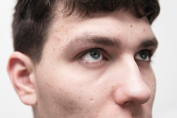 Obraz premium Close-up portrait of a young man, he has beautiful eyes, and pores and pimples are visible on his face, focus on the boy's eye